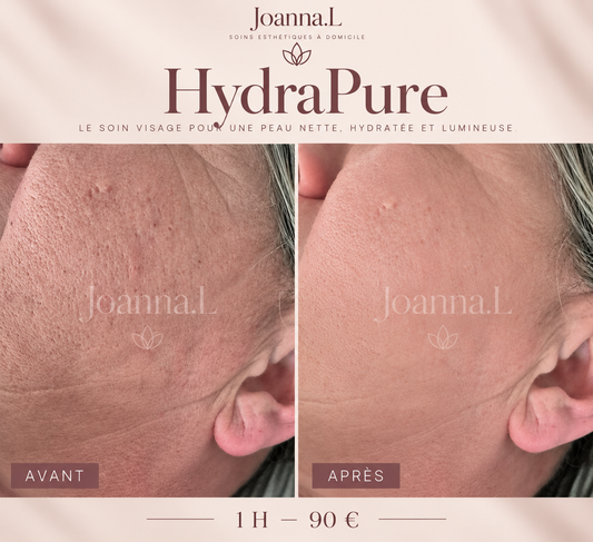 HydraPure : le soin visage pour retrouver une peau nette, hydratée et lumineuse